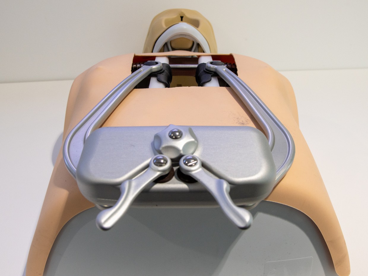 Viking Arm Medicals nye retraktor er mer regulerbar enn dagens Finnochietto-retraktorer.